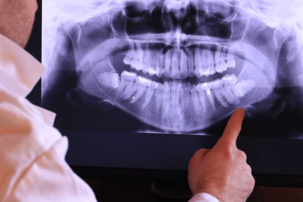 Best Emergency Dental Care for Broken or Chipped Teeth in Savannah, TN