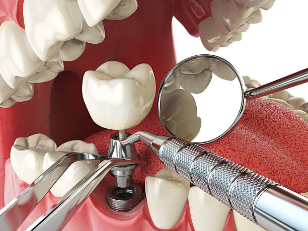 Best Urgent Care for Lost Fillings or Crowns in Savannah, TN