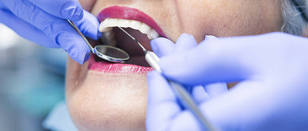 Best Emergency Gum Treatment in Savannah, TN